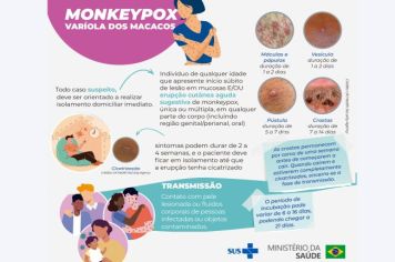 Pacientes suspeitos de monkeypox devem procurar UBS ou USF 