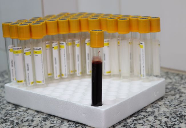 Campanha Junho Marrom verificará nível de ferritina 