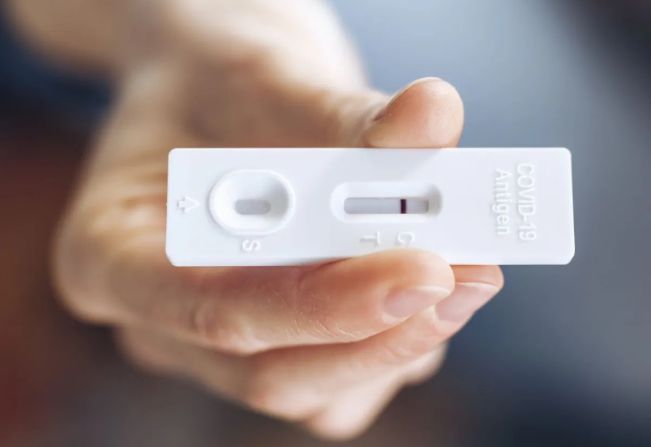 Autotestes para covid-19 devem ser notificados em unidades de saúde